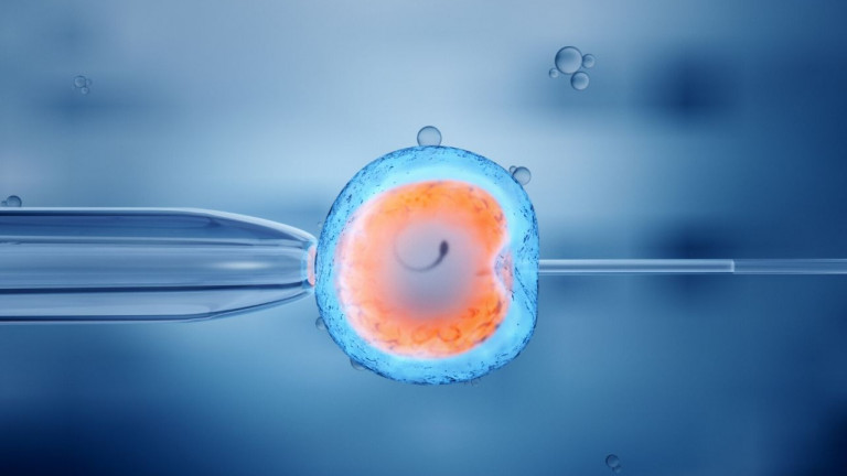 Frozen Embryo Transfer in IVF
