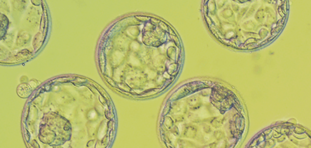 blastocyst embryo transfer
