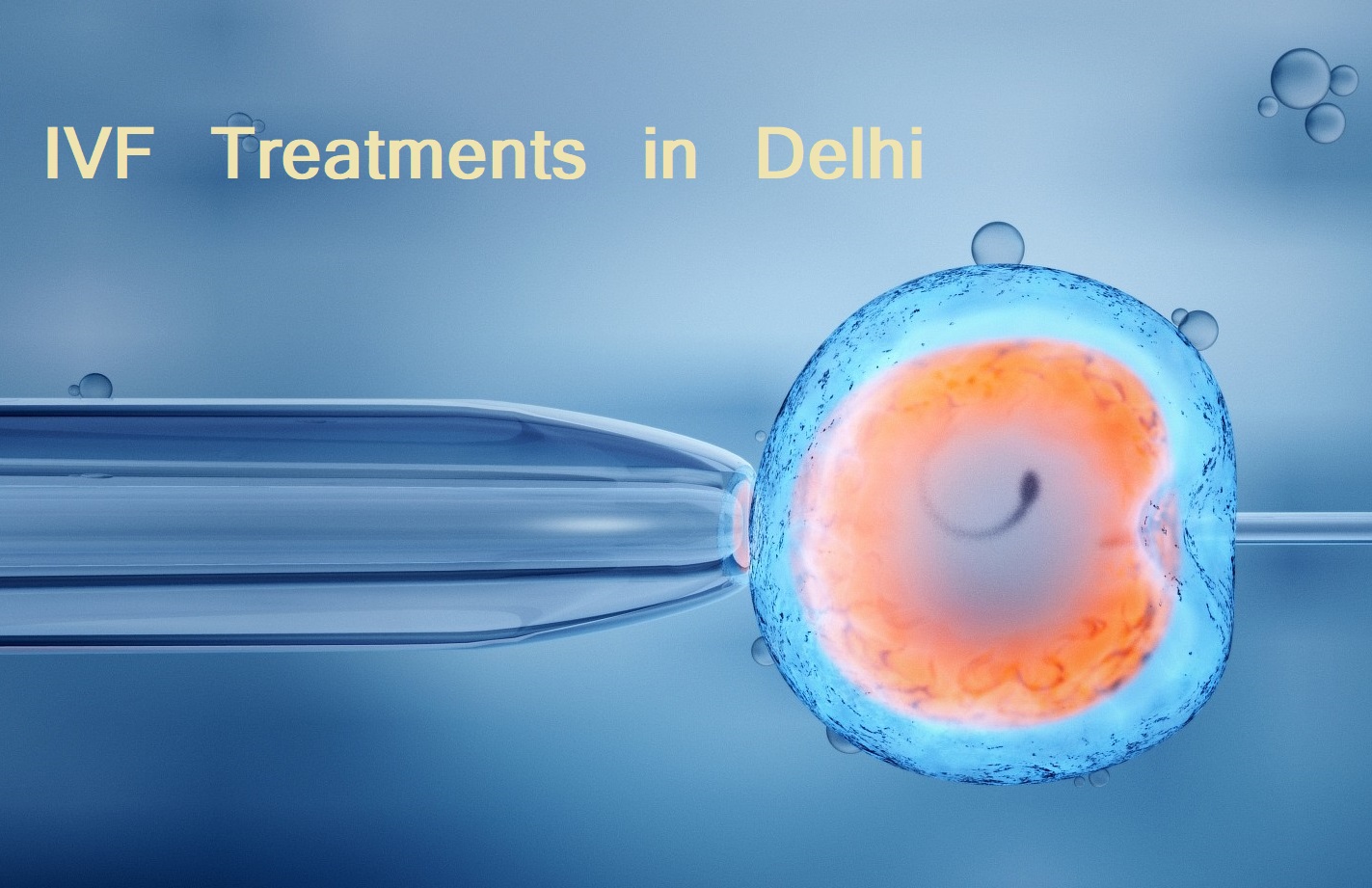 IVF TREATMENTS IN DELHI