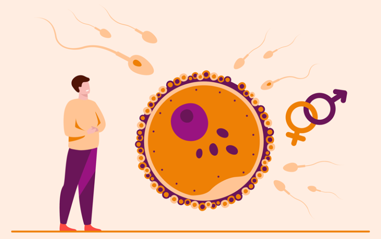 Male Infertility